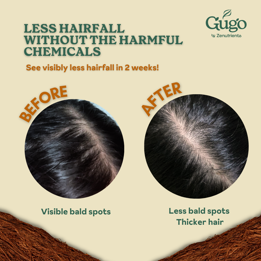 Zenutrients Gugo Strengthening Shampoo (Reduces Hairfall, Natural, Sul